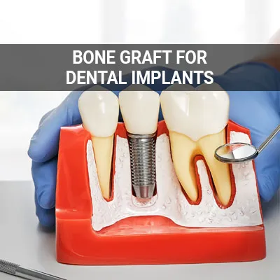 Visit our  Will I Need a Bone Graft for Dental Implants page