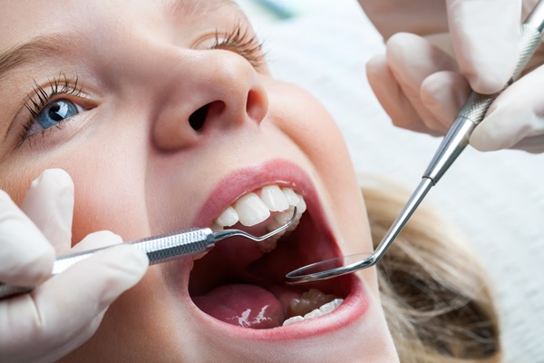 What Materials Are Used To Make Dental Sealants?