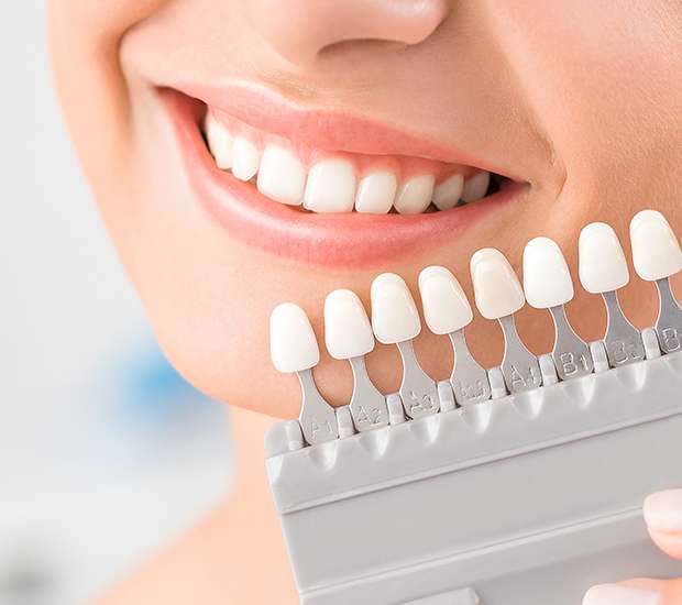Oaklyn Dental Veneers and Dental Laminates