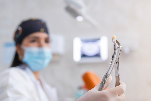 Facts About Tooth Extractions