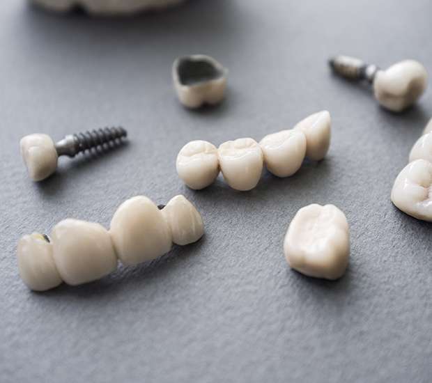 Oaklyn The Difference Between Dental Implants and Mini Dental Implants