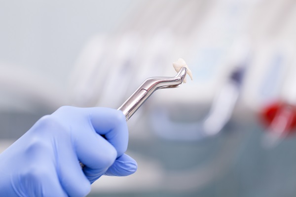 How Painful Can A Tooth Extraction Be?