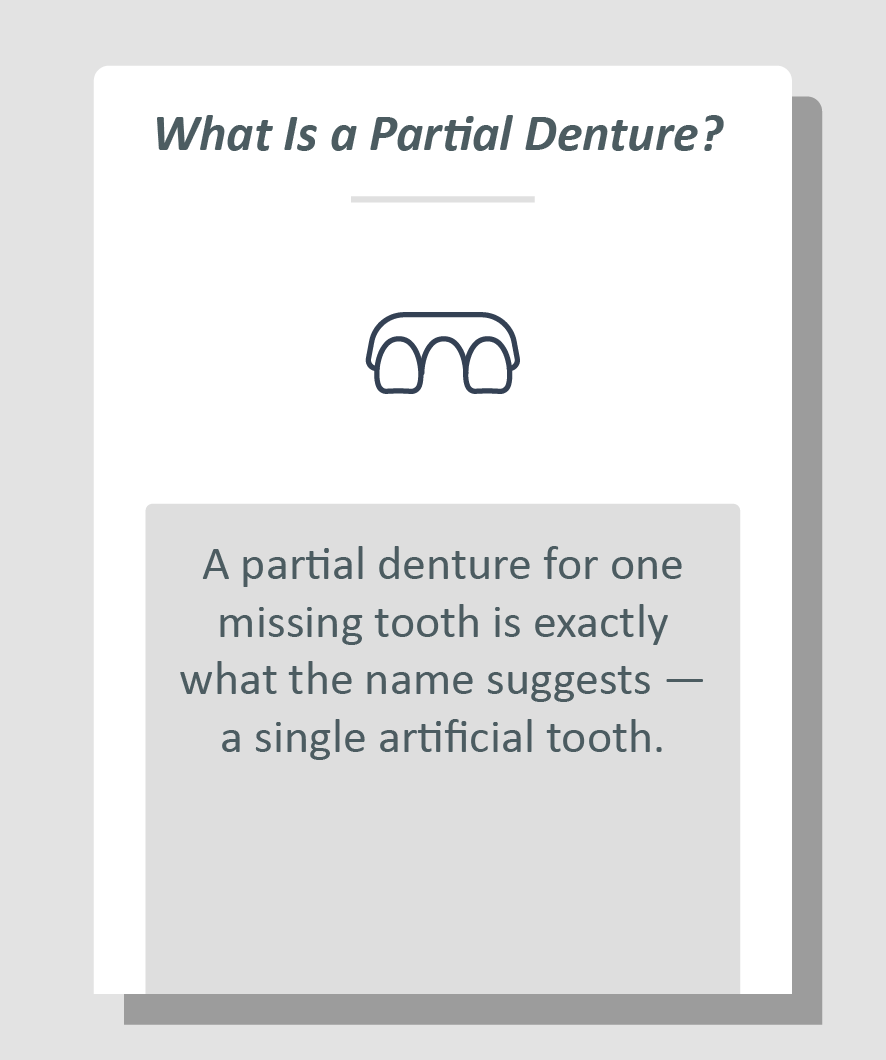 Partial denture for one missing tooth infographic: A partial denture for one missing tooth is exactly what the name suggests — a single artificial tooth.